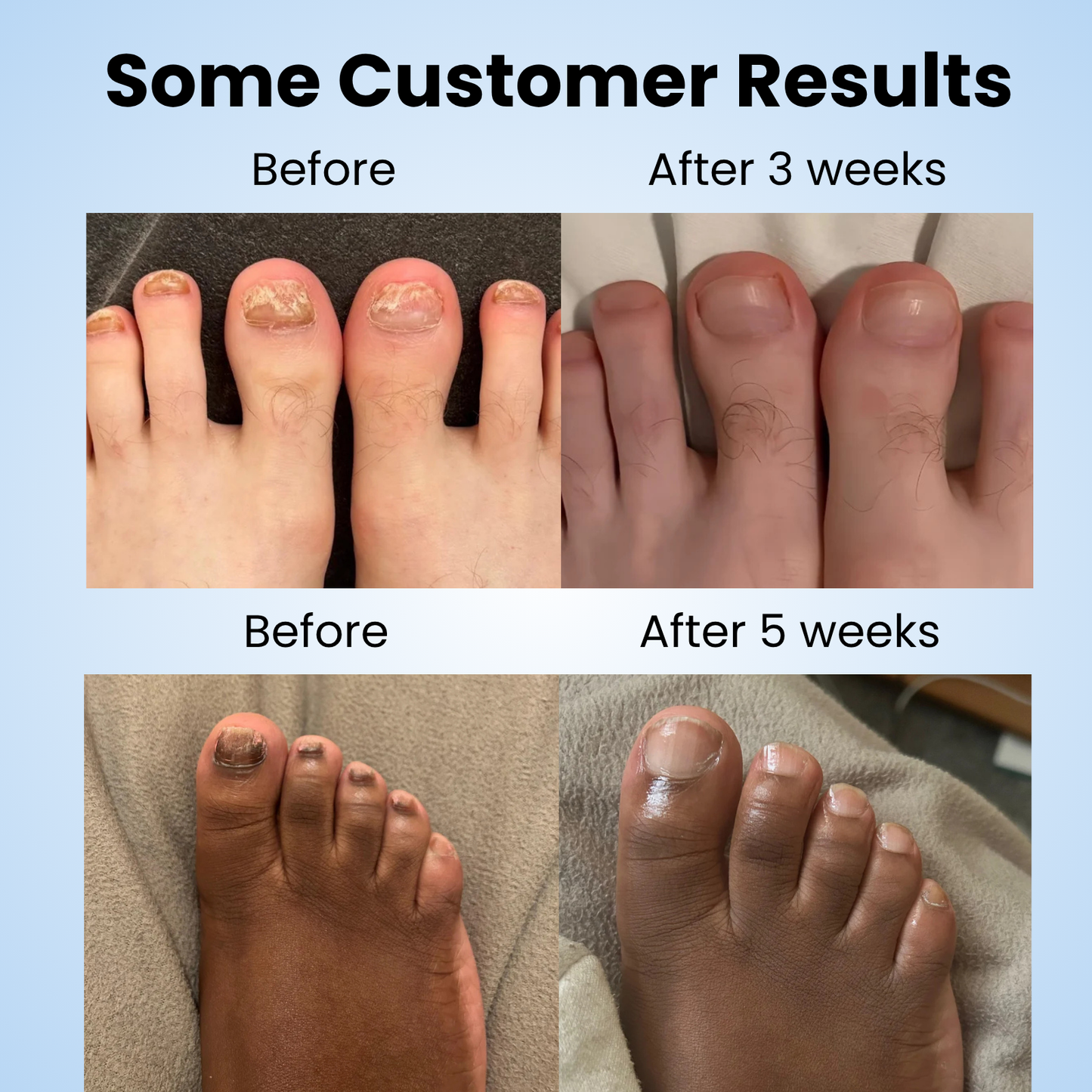 NOURVA overnight nail renewal patches