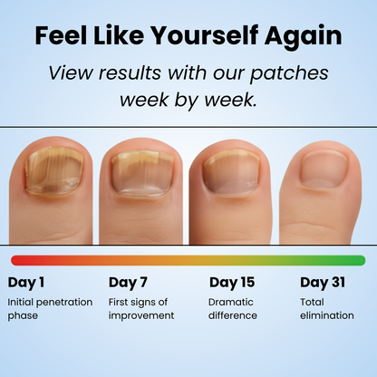 NOURVA overnight nail renewal patches